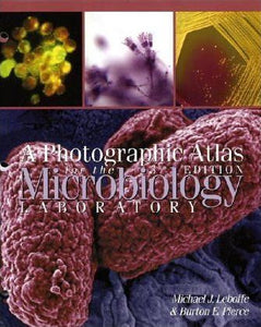PHOTO ATLAS FOR MICROBIOLOGY